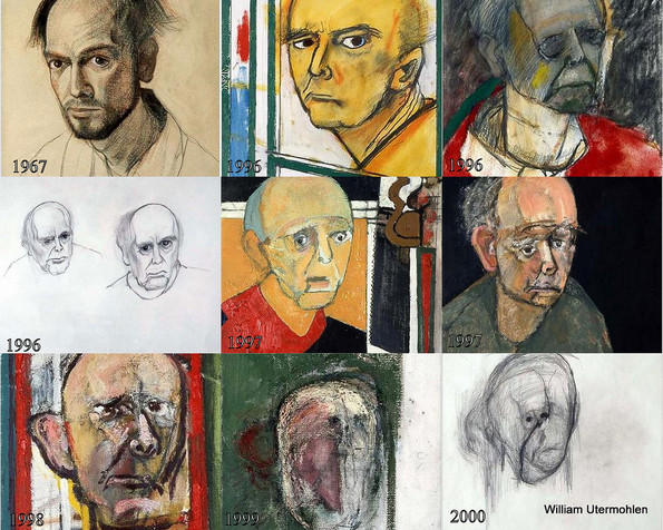 Self-portraits of William Utermohlen, showing the progression of his Alzheimer's.