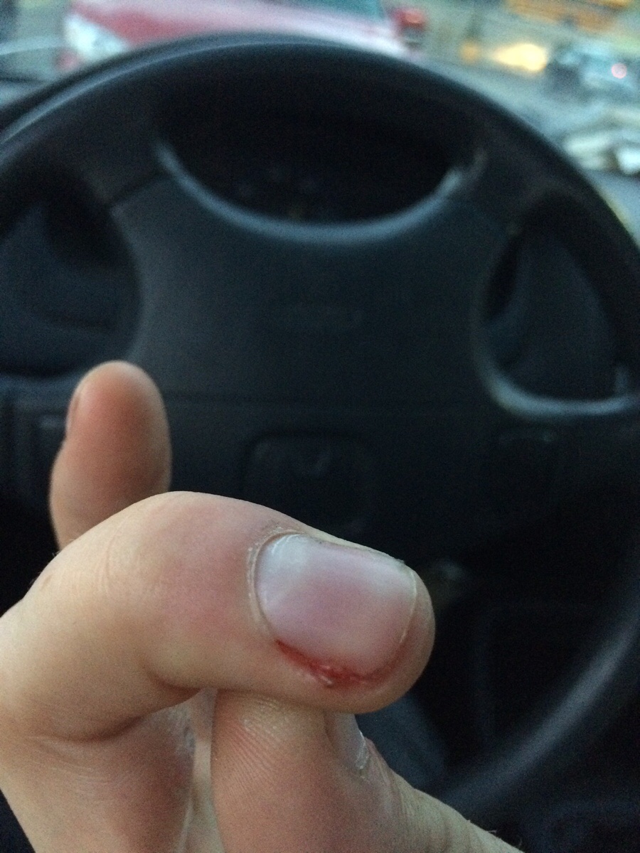 When your finger does this