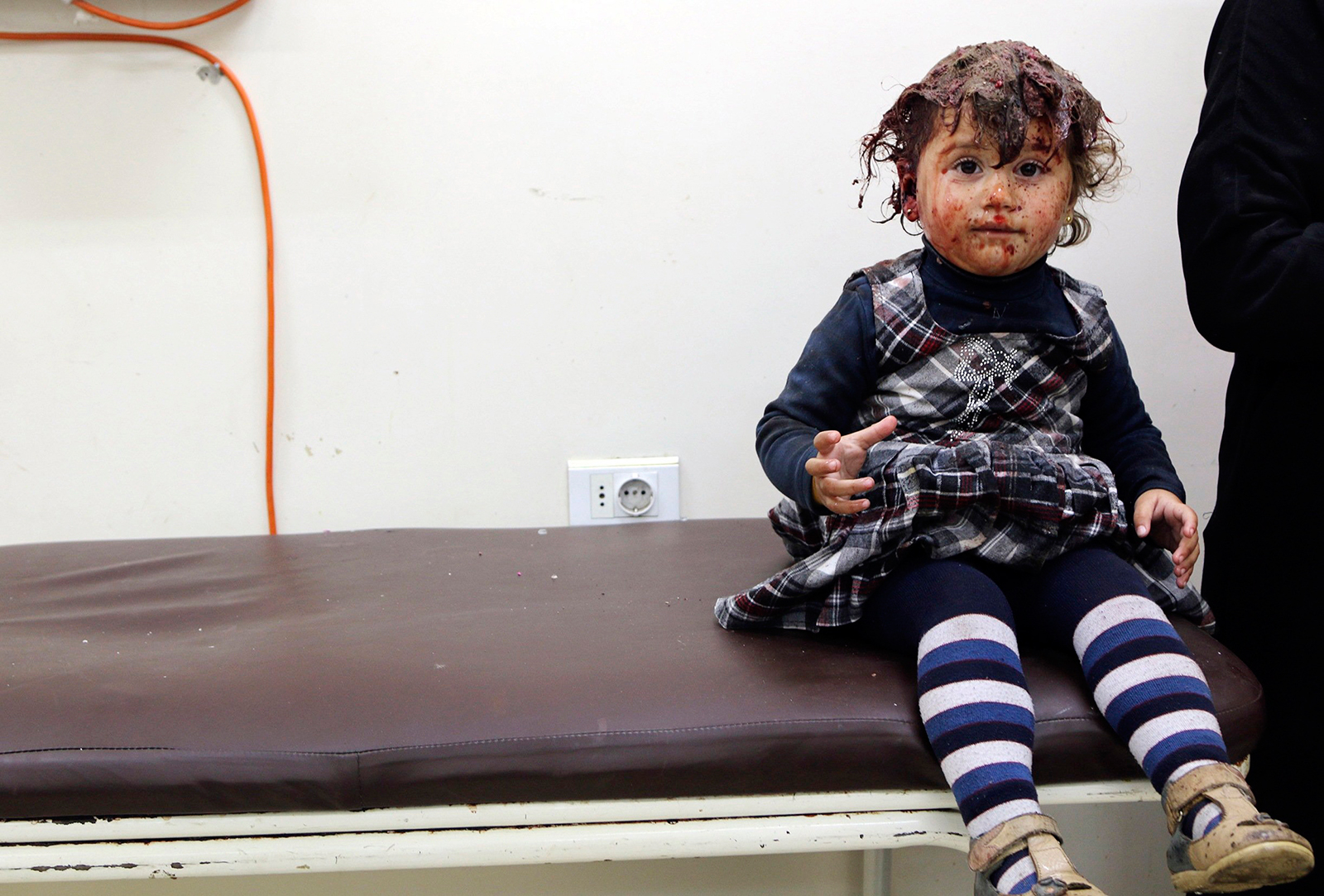 A shell-shocked syrian girl at a clinic after government airstrike.