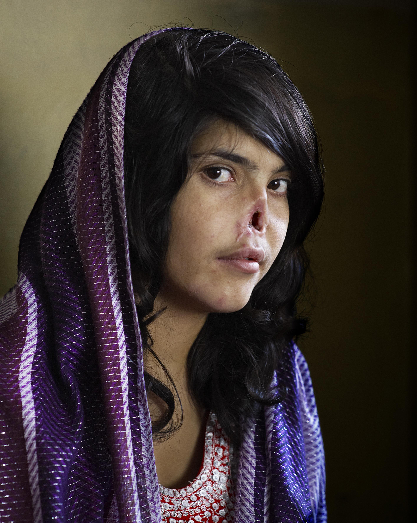 An Afghan woman who had her nose and ears cut off by the Taliban for trying to leave her husband.