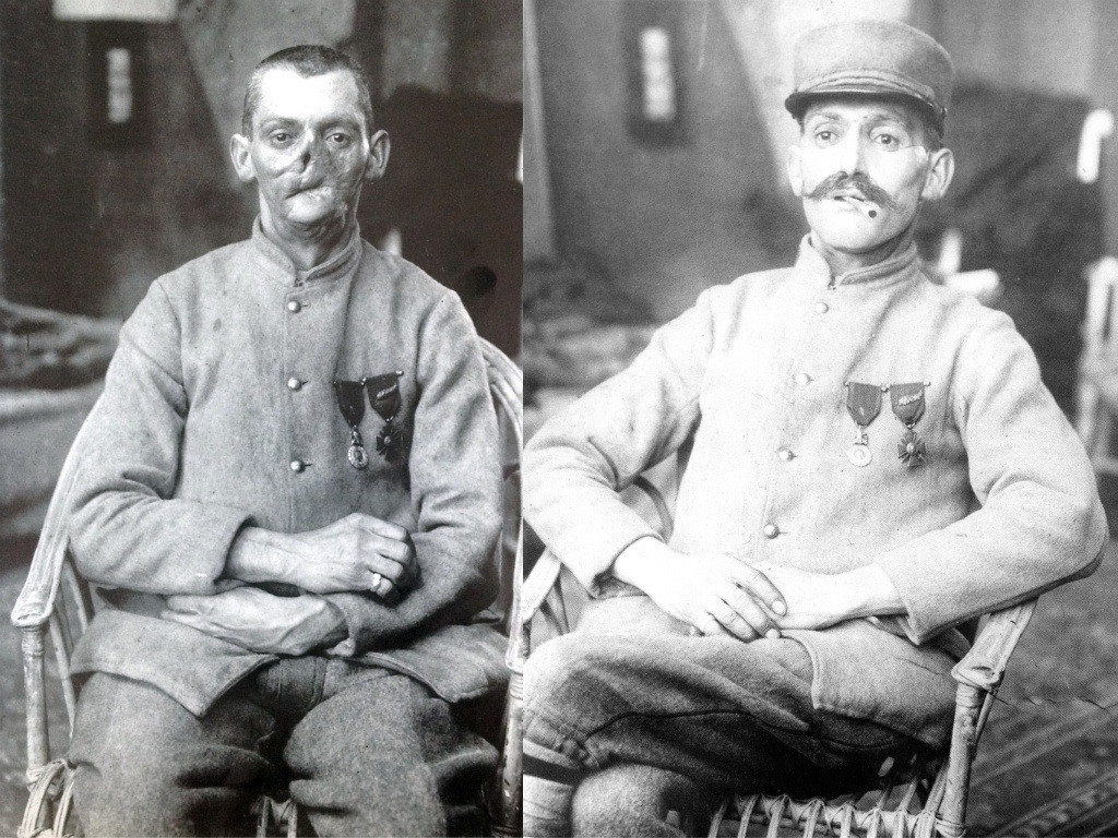 A disfigured French veteran of the First World War demonstrates face mask designed to disguise his wounds, 1920