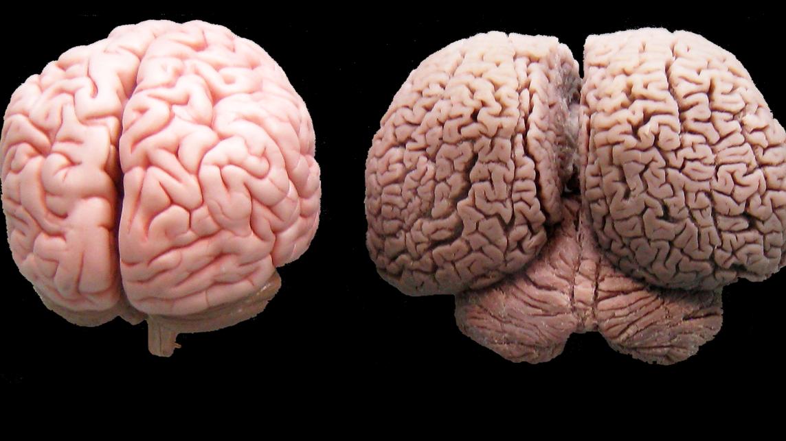 A human brain on the left; a dolphin brain on the right.