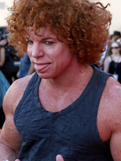 Carrot Top's hair made him famous, but his face made him infamous! The comedians face is no joke, and has allegedly been subject to an eyebrow lift, laser peels, and clearly a few too many rounds of Botox.