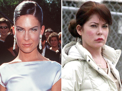 Lara Flynn Boyle remains tight-lipped on the topic of plastic surgery, but experts maintain that she has gotten several procedures as well as several reconstructive procedures, completely transforming her looks since her Twin Peaks years.