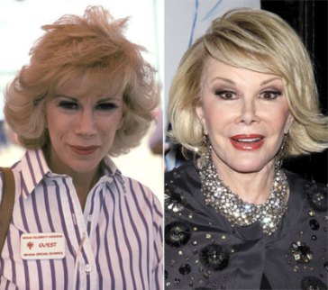 Joan Rivers has never been bashful when it comes to talking about the hundreds of plastic surgery procedures she has gotten over the years. She recently boasted that she has undergone 739 procedures in her 79 years, getting pretty much everything nipped, tucked and injected.