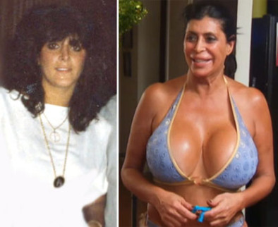 Big Ang isn't shy about sharing her plastic surgery history with the world! The Mob Wives star, who has drastically transformed since her youth and had her first boob job 27 years ago, has admitted she is obsessed with getting work done and has copped to several surgeries, such as three boob jobs, a tummy tuck, lipo and lip injections.