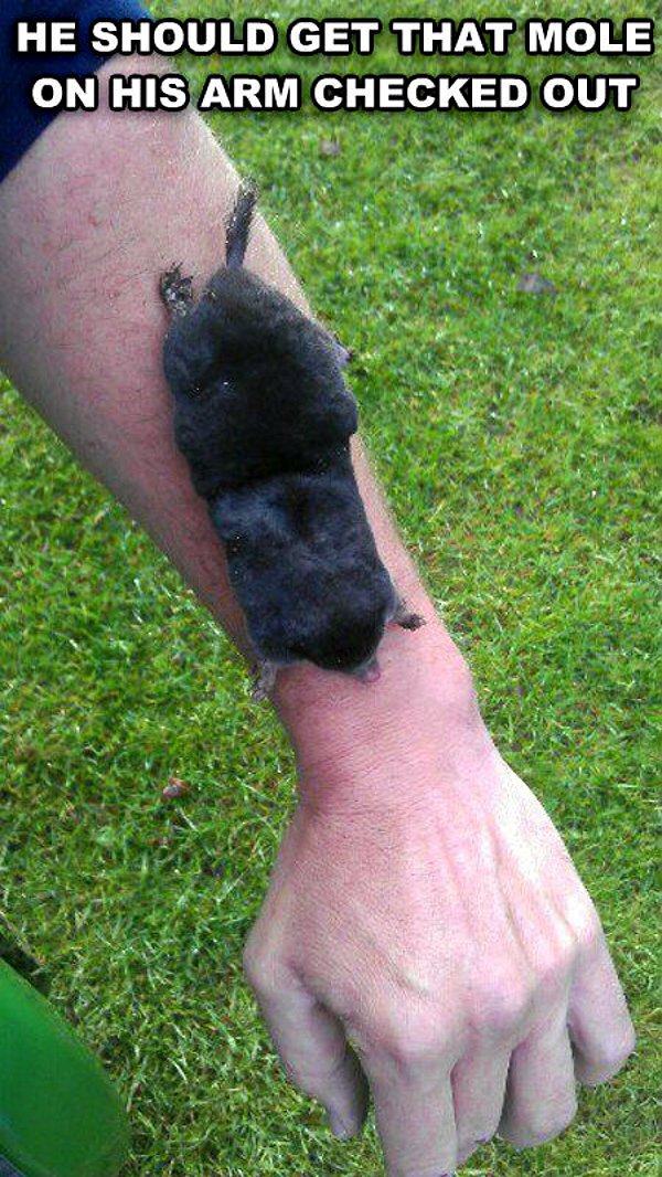 funny mole - He Should Get That Mole On His Arm Checked Out