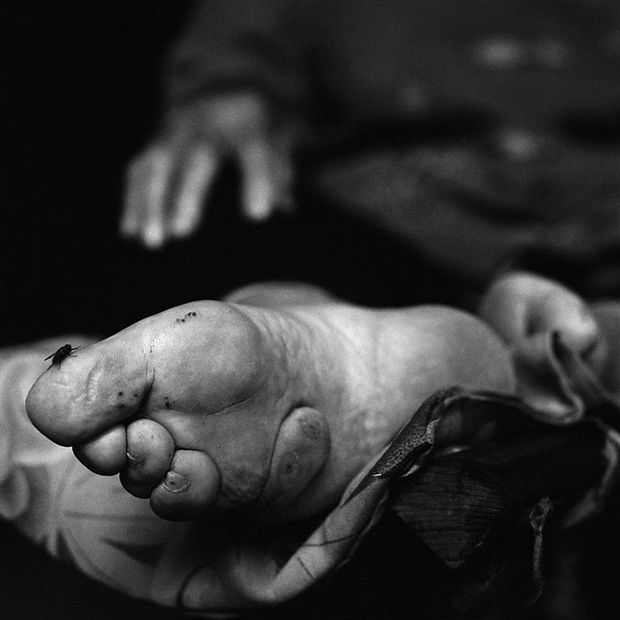 Foot Binding In China Is Coming To An End