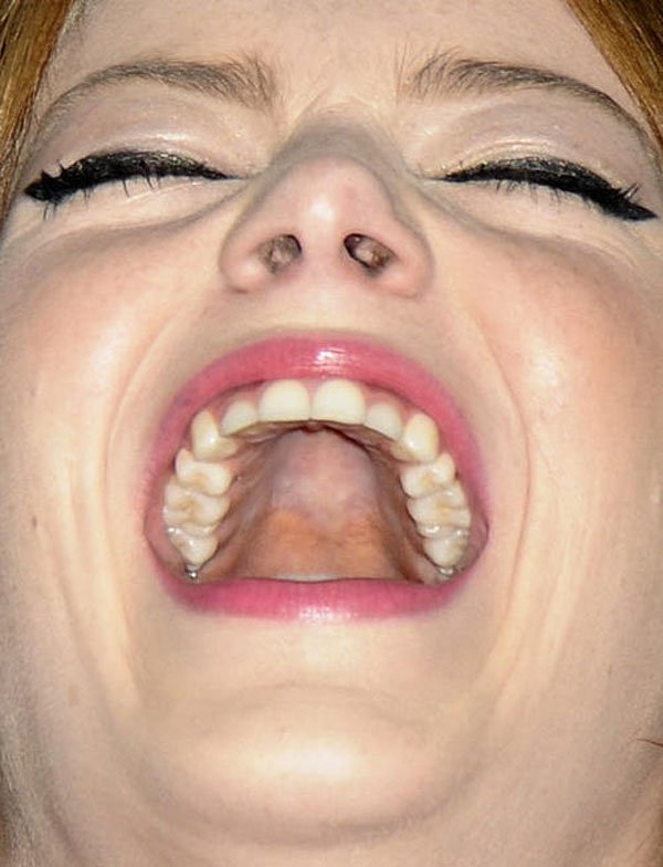 Close up of Emma Stone's nostrils