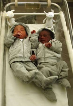 Twins born to mixed race couple.