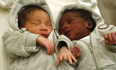 Twins born to mixed race couple.