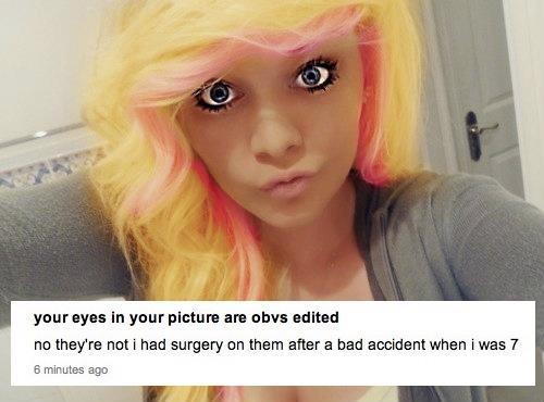 bad photoshop eyes - your eyes in your picture are obvs edited no they're not i had surgery on them after a bad accident when i was 7 6 minutes ago