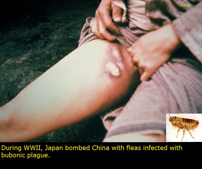bubonic plague - Ebw During Wwii, Japan bombed China with fleas infected with bubonic plague.