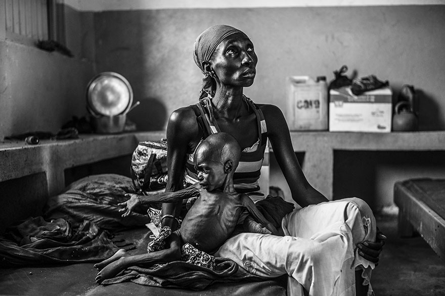 Guidi Oumarou (19) and her son awaiting treatment in the Central African Republic .