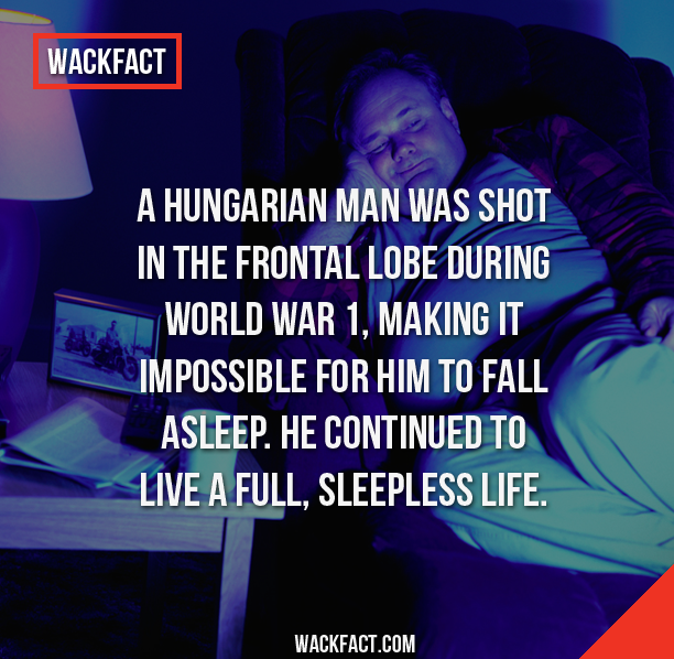 wack facts - Wackfact A Hungarian Man Was Shot In The Frontal Lobe During World War 1, Making It Impossible For Him To Fall Asleep. He Continued To Live A Full, Sleepless Life. Wackfact.Com
