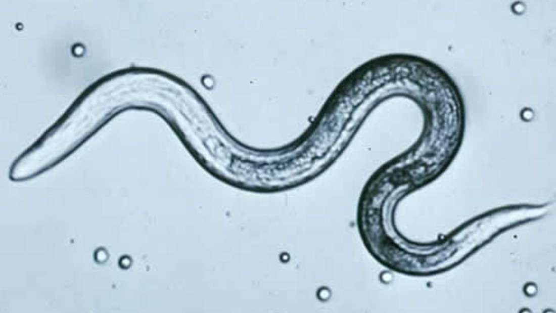 parasitic worms under a microscope - ,