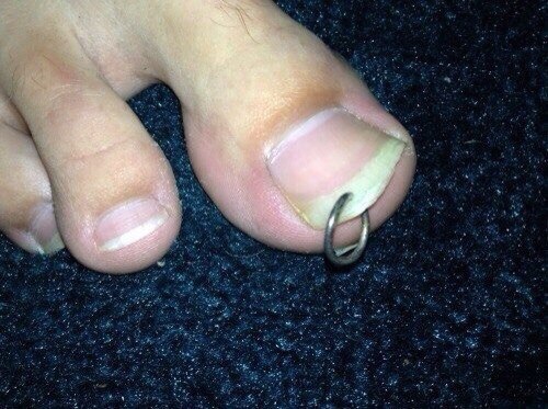random pic pierced toenail