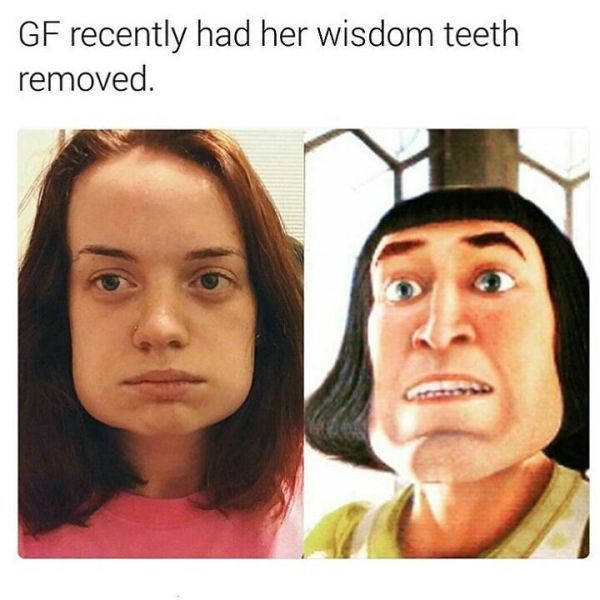 GF had teeth removed and looks like cartoon character with very wide and flat jaw line.