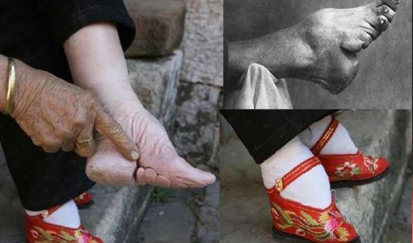 chinese foot binding