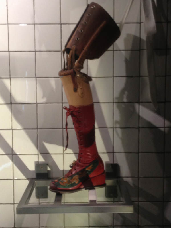 Frida Kahlo's Prosthetic Leg -Considering the iconic artist Frida Kahlo’s former home of Casa Azul in Mexico City is now a museum to honor her, it’s no surprise that that’s where her prosthetic leg ended up … wearing one of her colorful pieces of footwear. Kahlo lost her right leg at the knee in 1953 to gangrene contracted from a previous surgery.