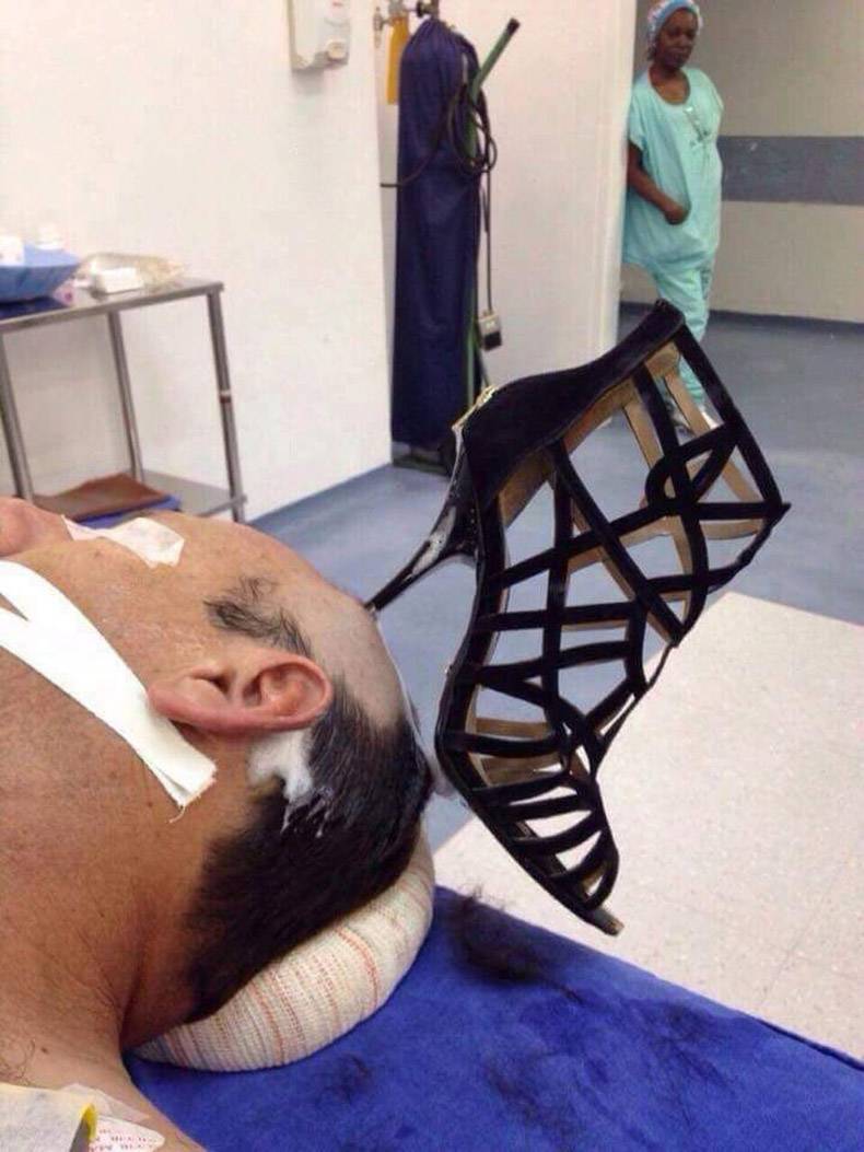 funny picture of WTF a man has a woman's high heel shoe stuck in his head