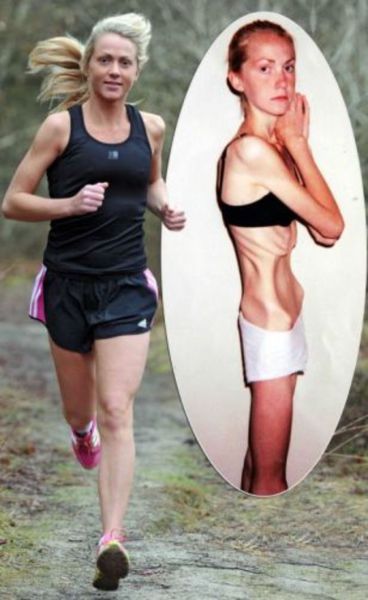 Harriet Smith struggled with an eating disorder for years, at one point weighing only 70 lbs. When she was told that she was just weeks away from death, she made an effort to change her life. Now, she weighs about 120 lbs and is a strong, active runner.