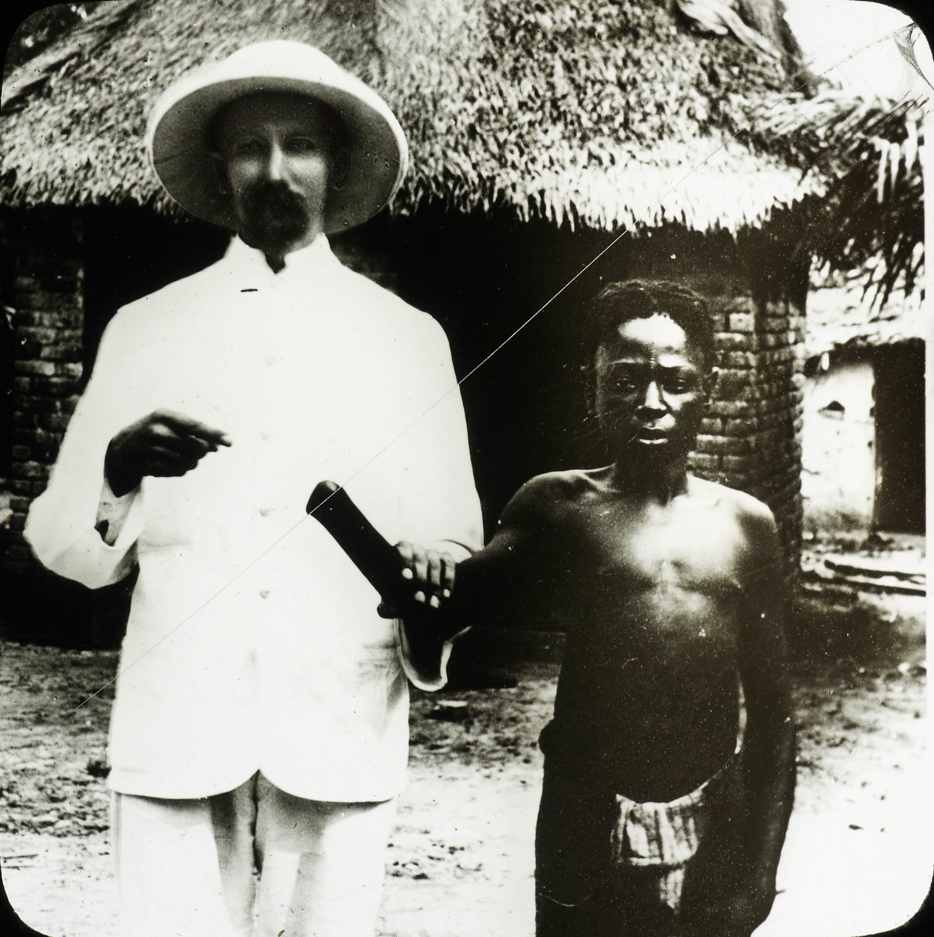 A European missionary shows a young boy with his hand cut off in Belgian Congo in 1903. The territory was privately owned by King Leopold II of Belgium, and the native people were used in forced labor to pay off the Kings debts. If they did not meet their quota, hired mercenaries would routinely chop off the limbs of the workers children, so the workers could still work. The workers were basically slaves, suffering from horrible atrocities Leopold's private army would do at will. The territory was called the Congo Free State, and was anything but. When it finally came out what was going on after almost 25 years, Leopold II gave up control, and things finally changed. However, this was one of the last areas that instituted forms of slavery on a country wide scale, nearly 50 years after the US eliminated it. It also employed forms of genocide, and its possible up to 20 million people died during the 25 or so years it went on. Exact figures are unknown, but it was bad, really bad.