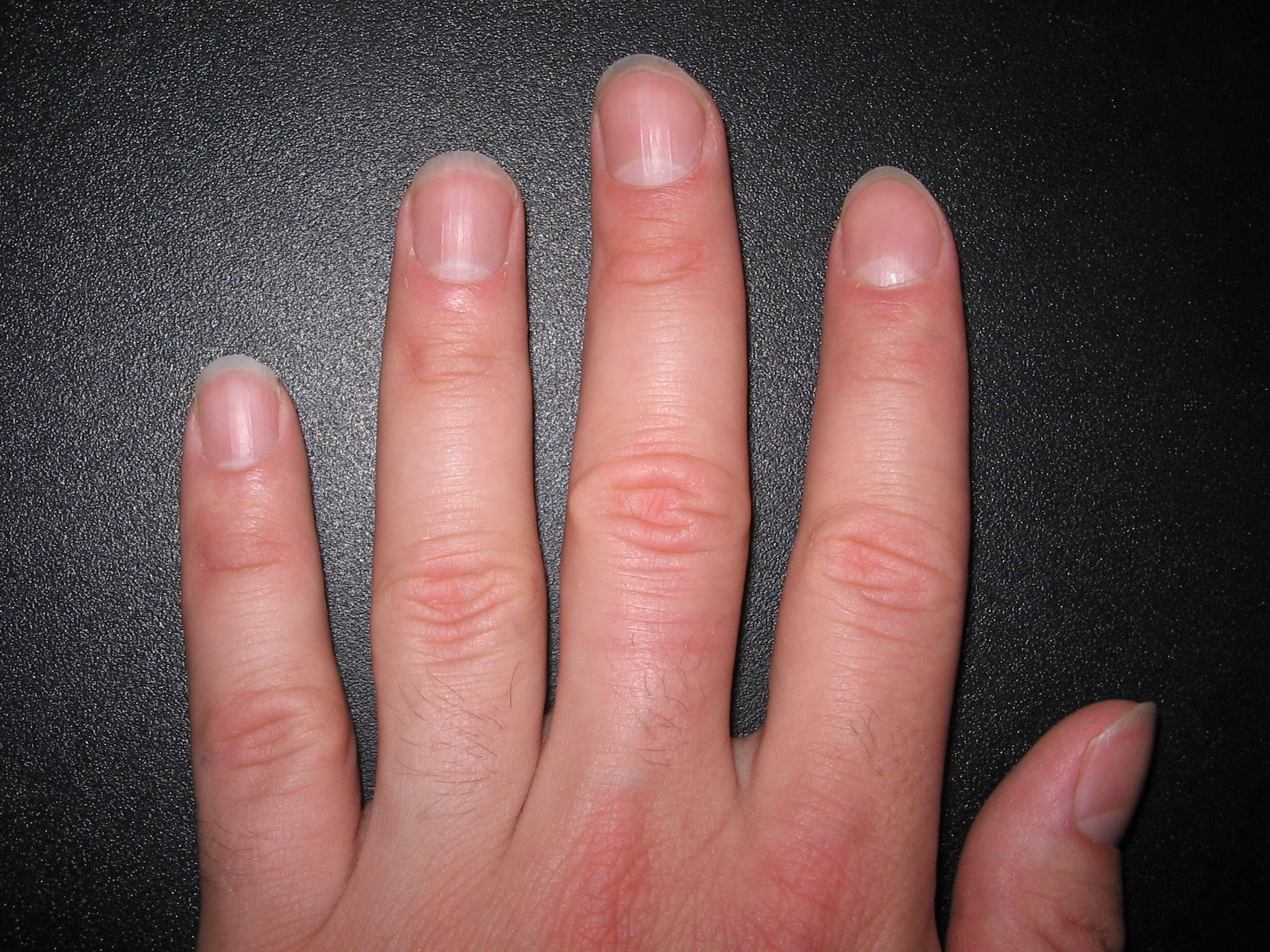 human fingernails