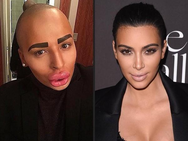 ordan James Parke to Kim Kardashian

$150k spread across 50 surgeries to achieve Kim K’s “look”.