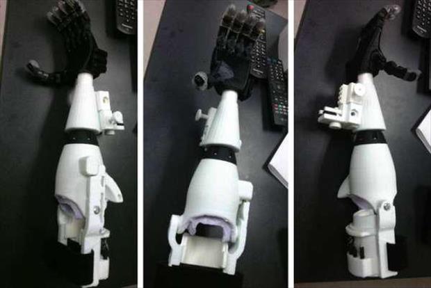 Kid Gets An Amazing Prosthetic Storm Trooper Arm!