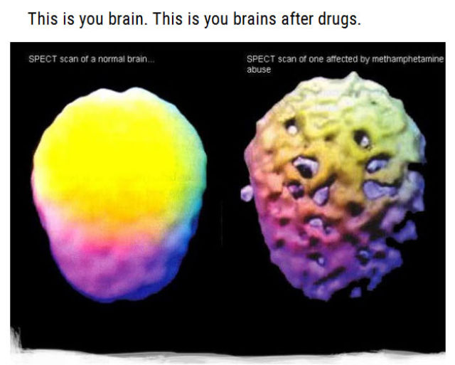 Just Don’t Do Drugs People!