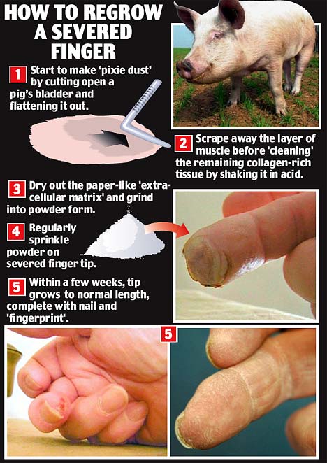 Regrow a severed finger in 5 simple steps. Also, maybe don't actually try this.