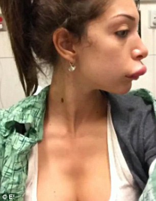 Fara posted these photos on Twitter after she had a horrific allergic reaction