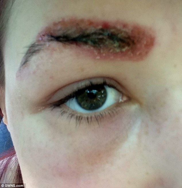 Now weeks later Polly claims her eyebrows have started to fall out. The teenager is warning other young women to be wary of the treatment, which has left her self-conscious.