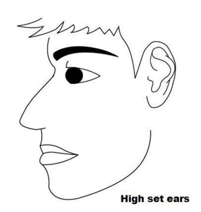 If You Have High Se Ears: Got Ears That Are Set High? You are an intelligent person who likes to reflect on things before making a decision. You may also be a very boring person and one who keeps to themselves. You are artistic yet don't enjoy music much.