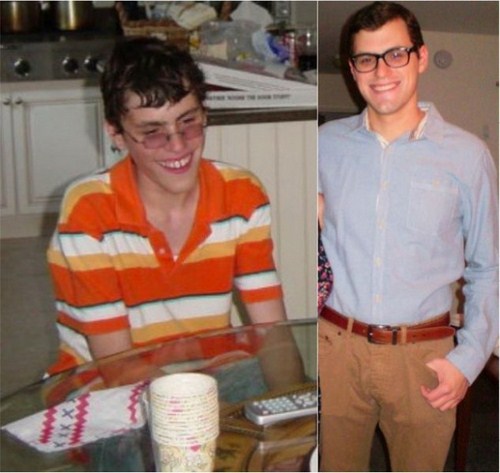 puberty nerd ugly