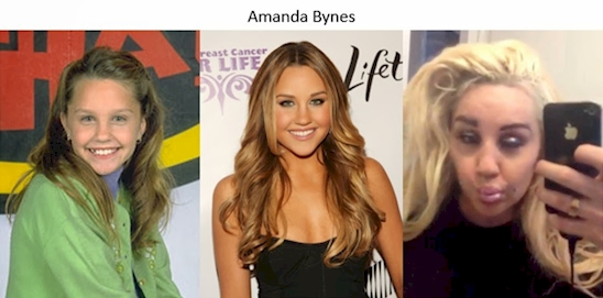 Amanda Bynes.


Bynes struggled to make the leap from children’s TV star to movie star. In 2012, she was involved in a number of car crashes, got a DUI, went on a now infamous Twitter tirade and was arrested for marijuana possession. The retired actress was recently spotted in West Hollywood looking healthy and more together.