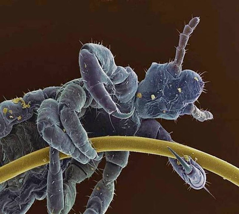 A Head Louse Clinging to a Human Hair