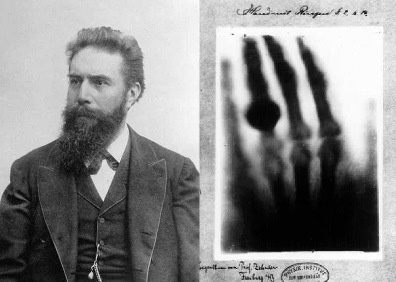 X-ray, 1895. Inventor : Wilhelm Conrad Roentgen