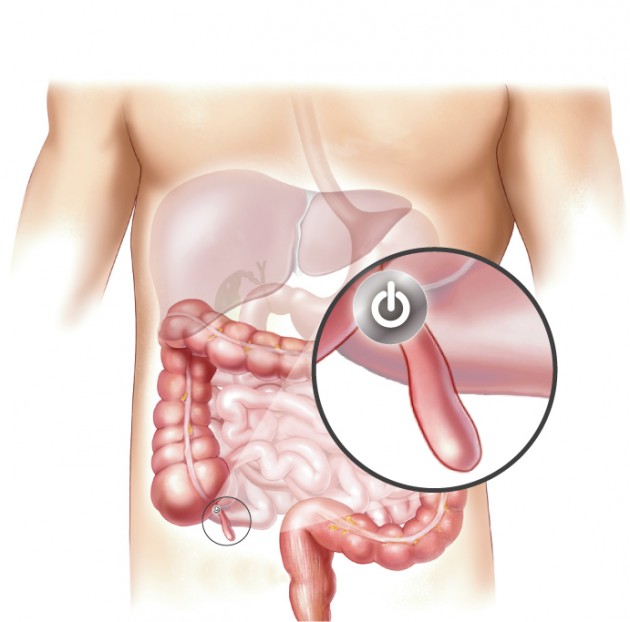 Appendix: Man has come along way. From ages past, the appendix was a very useful organ especially for our digestion. However after man discovered fire and learned how to cook, of what use is the appendix if our food can now be easily digested.