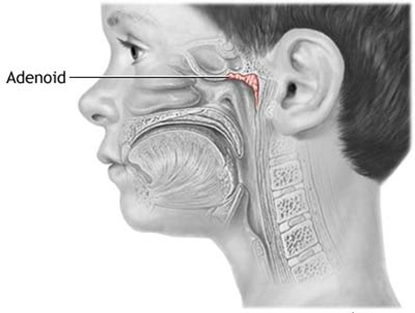 Adenoids: Although they are useful in trapping bacteria, adenoids are shed off together with tonsils. Otherwise, they just disappear unnoticed as we grow up.