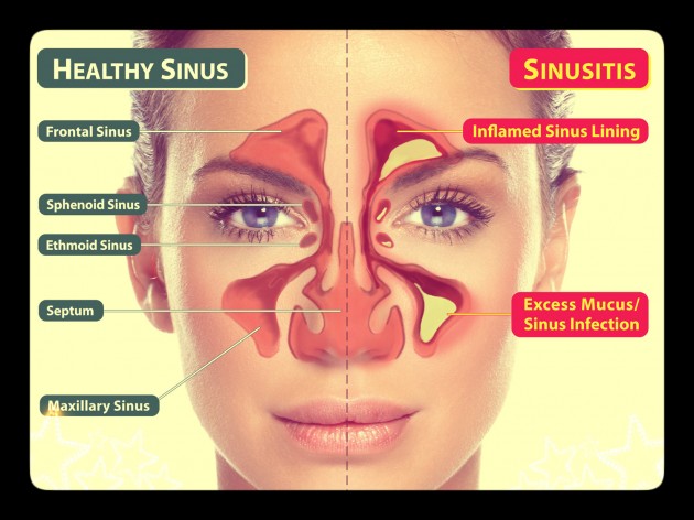 Sinuses: Apart from theories that they affect our sight or the tone of voices, sinuses are organs that we can do away with, especially when they give the doctor so much trouble to figure out stuff.