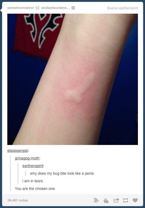 tumblr - most amazing - wintertormentor andiamburdene... Source earthenspirit stasiasenpai grinagogmoth earthenspirit why does my bug bite look a penis I am in tears You are the chosen one 24,461 notes