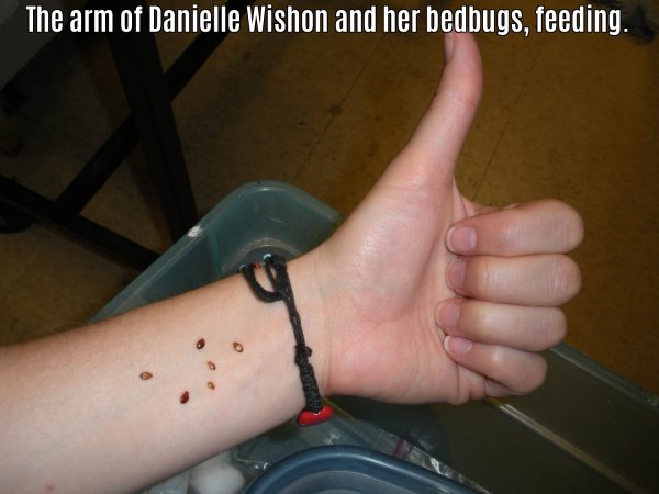 16 People Who Let Bugs Do Weird Things To Them