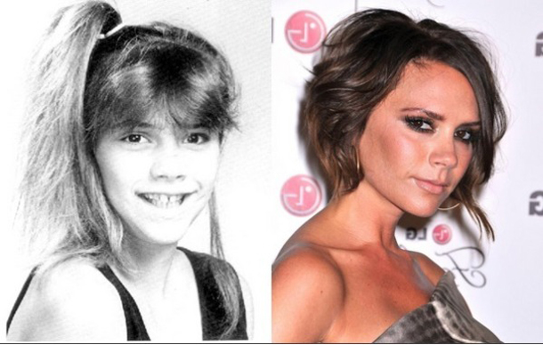 Celebrities That Used to be Ugly But Now Are Super Hot