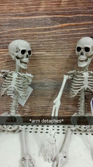 skeleton snapchats - arm detaches