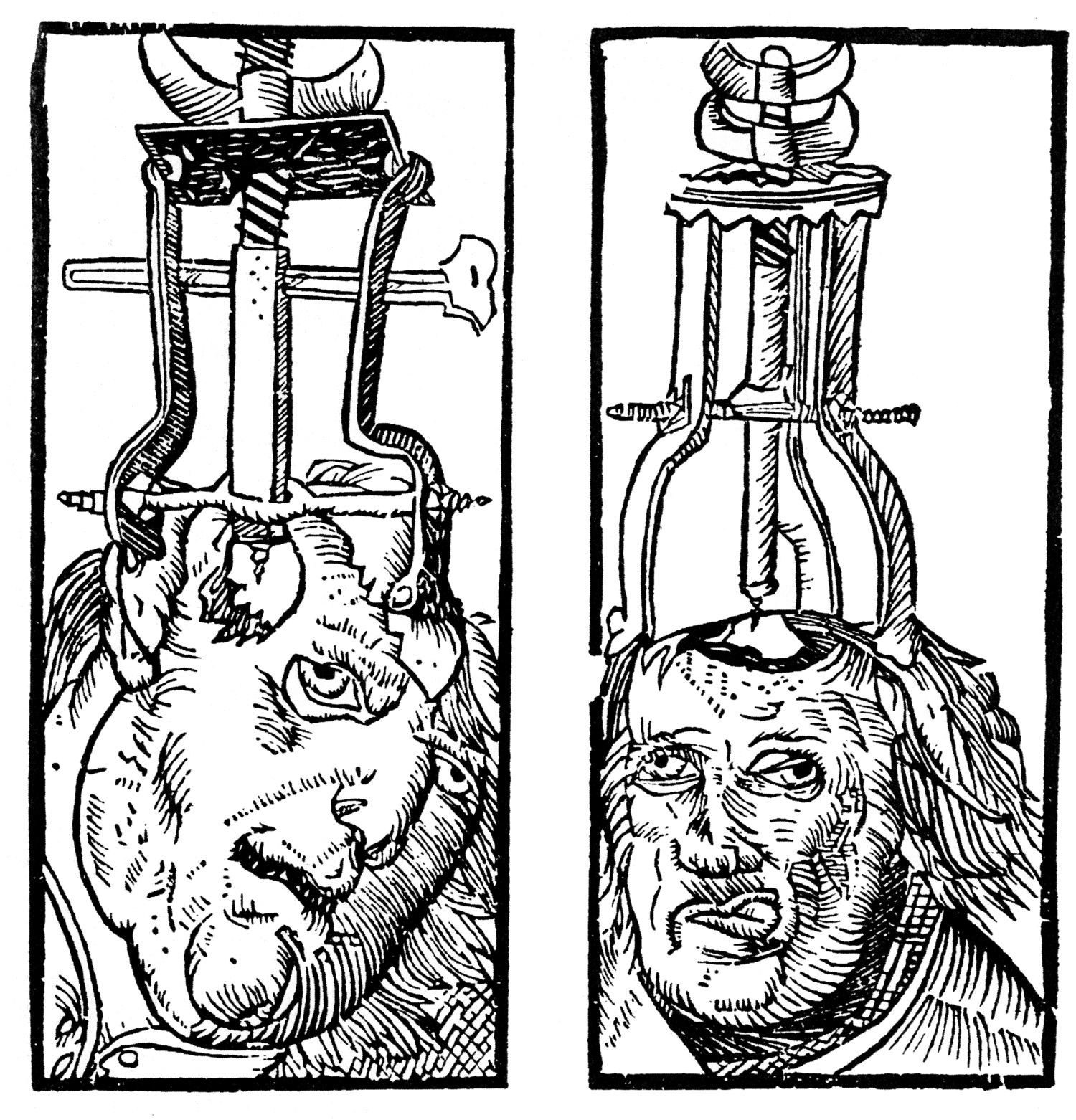Trepanning: The procedure of drilling a hole into the skull to treat intracranial complications or any issues regarding the head. During the Medieval era, a sufferer of a mental disease was considered possessed by evil spirits and had to go through the procedure of trepanning. The procedure obviously extremely risky, and patients hardly ever survived. But there were some records of "successful" trepanning in which people lived with a new soft spot.