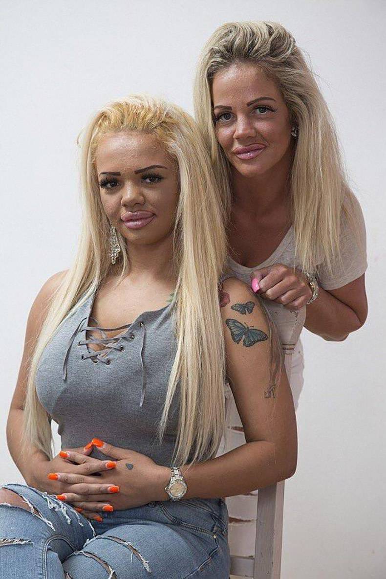 Two woman posing who have had way too much plastic surgery.