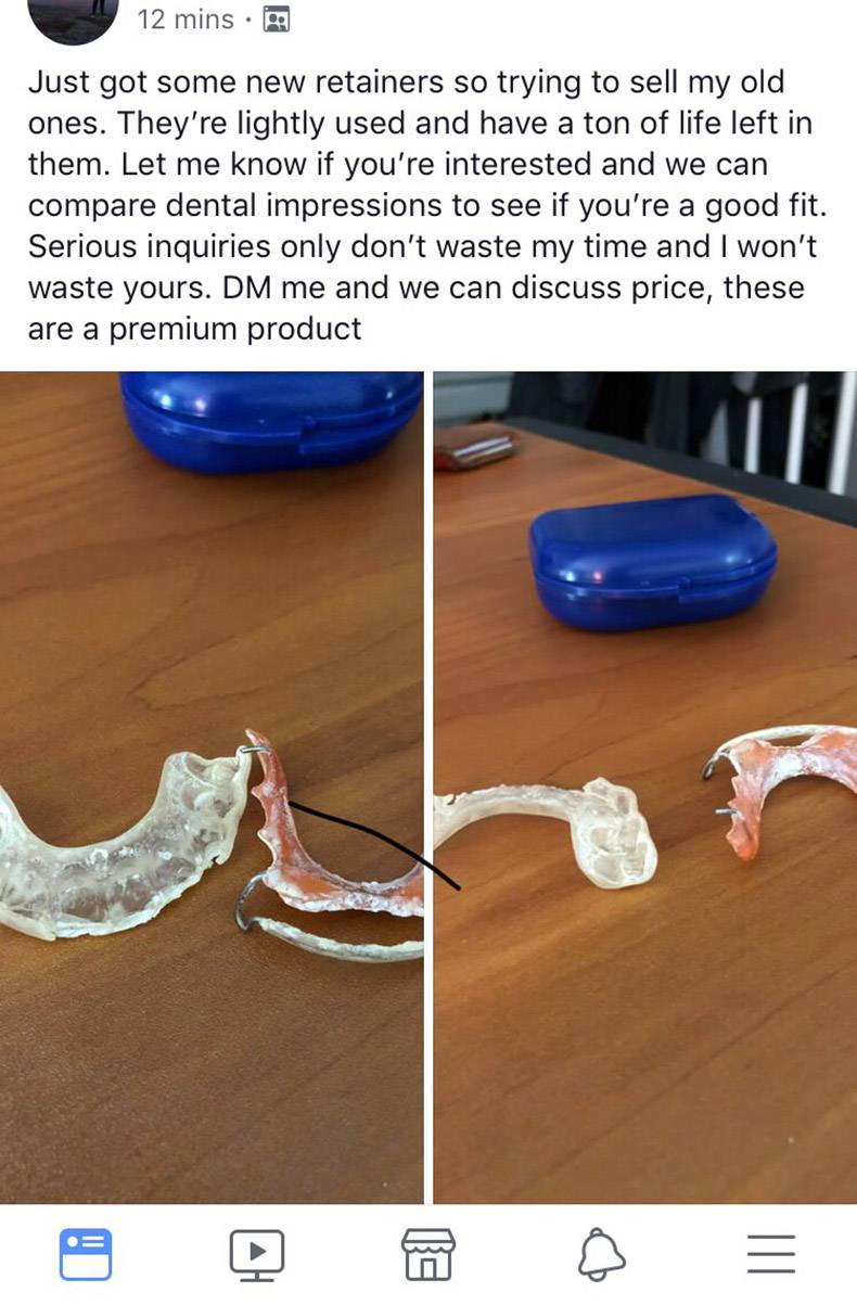 jaw - 12 mins Just got some new retainers so trying to sell my old ones. They're lightly used and have a ton of life left in them. Let me know if you're interested and we can compare dental impressions to see if you're a good fit. Serious inquiries only d