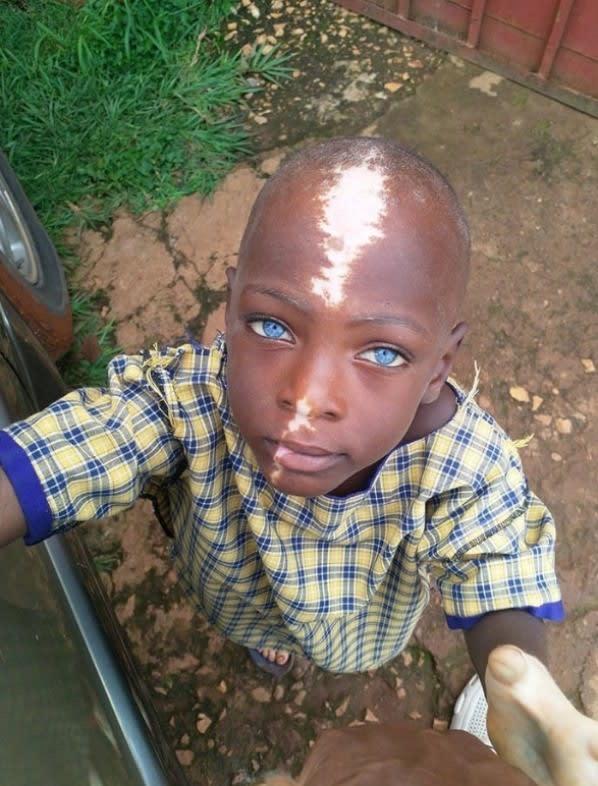 african mute kid with blue eyes and avatar scar